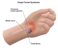 Causes Of Hand Surgery, Hand Operation In India, Facilities For Hand Surgery
